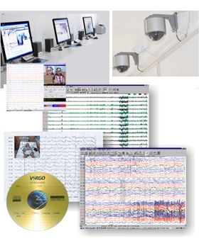 數(shù)字化視頻腦電監(jiān)護分析系統(tǒng)