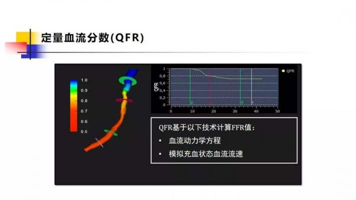 定量血流分數(shù)測量軟件AngioPlus Core