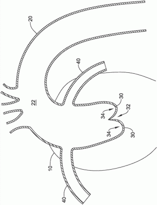 經(jīng)導管主動脈瓣膜系統(tǒng)EVOLUTPRO-23-US