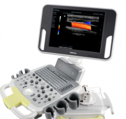 彩色多普勒超聲診斷系統s60s