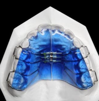 華偉定制式矯治器擴弓型、矯治保持型、牙膠片型