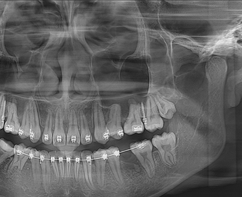 美亞光電mydentviewer口腔醫(yī)學(xué)影像處理軟件